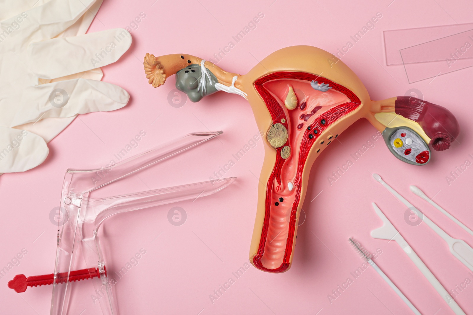 Photo of Gynecological examination kit and anatomical uterus model on pink background, flat lay