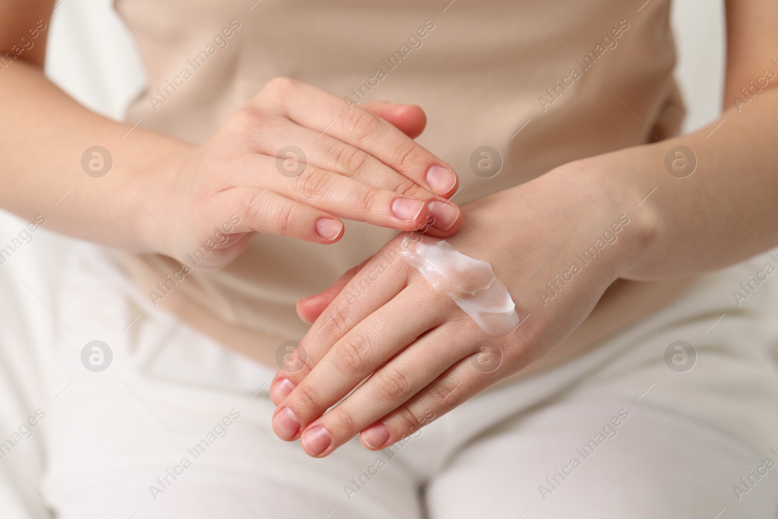 Photo of Young woman with dry skin applying cream onto her hand, closeup