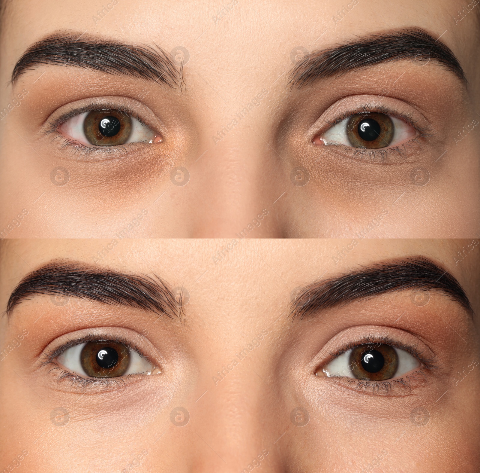 Image of Collage with photos of tired woman with dark circle under eye and after rest, closeup