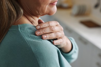 Photo of Woman brushing dandruff off her sweater indoors, closeup