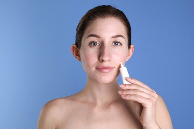 Young woman with acne problem applying cosmetic product onto her skin on blue background