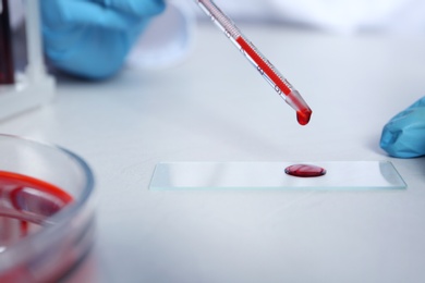 Photo of Laboratory worker running blood test on table, closeup view. Research and analysis