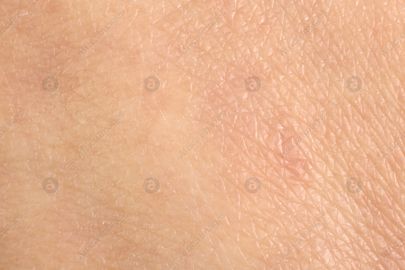 Photo of Texture of healthy skin as background, macro view