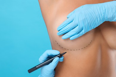 Image of Breast augmentation. Doctor with marker preparing woman for plastic surgery operation against light blue background, closeup. Space for text