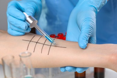 Photo of Doctor doing skin allergy test in clinic, closeup