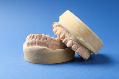 Photo of Dental model with gums on blue background. Cast of teeth