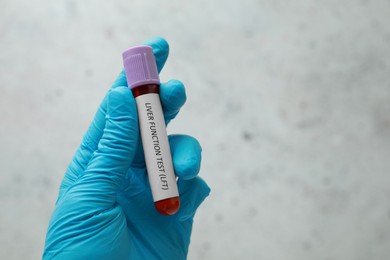 Laboratory worker holding tube with blood sample and label Liver Function Test against light background, closeup. Space for text