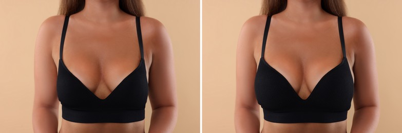 Image of Woman before and after breast augmentation on beige background, closeup. Collage with photos showing difference between breast sizes