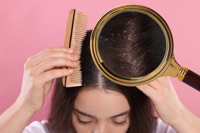 Image of Woman suffering from dandruff on pink background, closeup. View through magnifying glass on hair with flakes