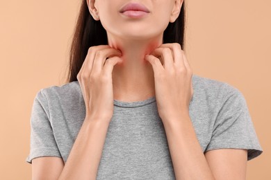 Suffering from allergy. Young woman scratching her neck on beige background, closeup