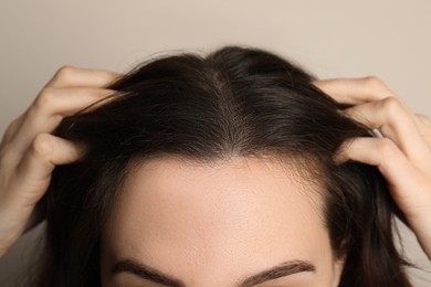 Woman suffering from baldness on grey background, closeup
