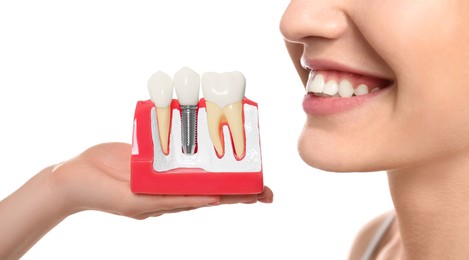 Image of Young woman with beautiful smile and dentist holding educational model of dental implant on white background, closeup