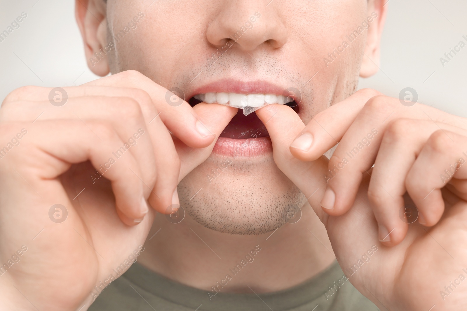 Photo of Young man applying whitening strip on his teeth against light grey background, closeup