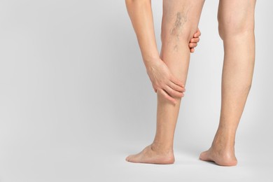 Photo of Closeup view of woman suffering from varicose veins on light background. Space for text
