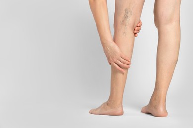 Closeup view of woman suffering from varicose veins on light background. Space for text