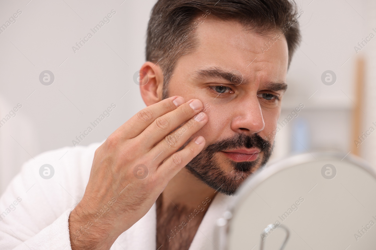 Photo of Confused man with skin problem looking at mirror indoors