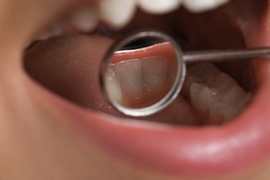 Examining woman's teeth with dentist's mirror, closeup