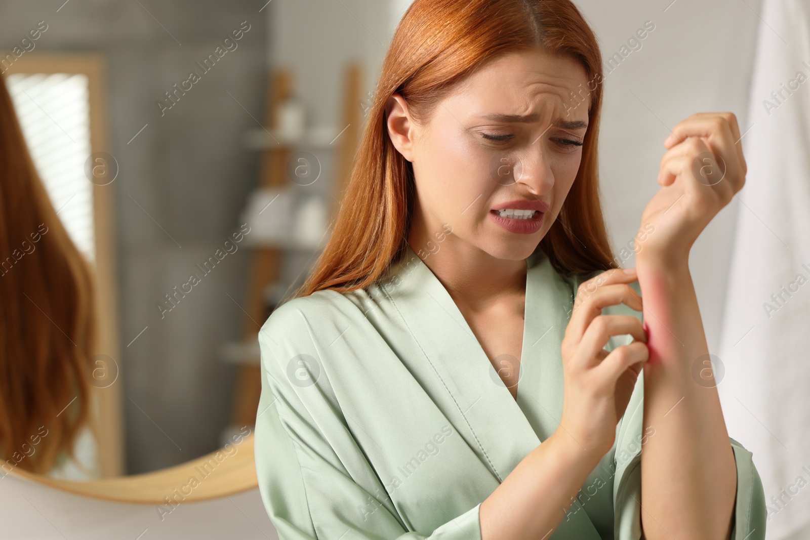 Photo of Suffering from allergy. Young woman scratching her arm in bathroom, space for text