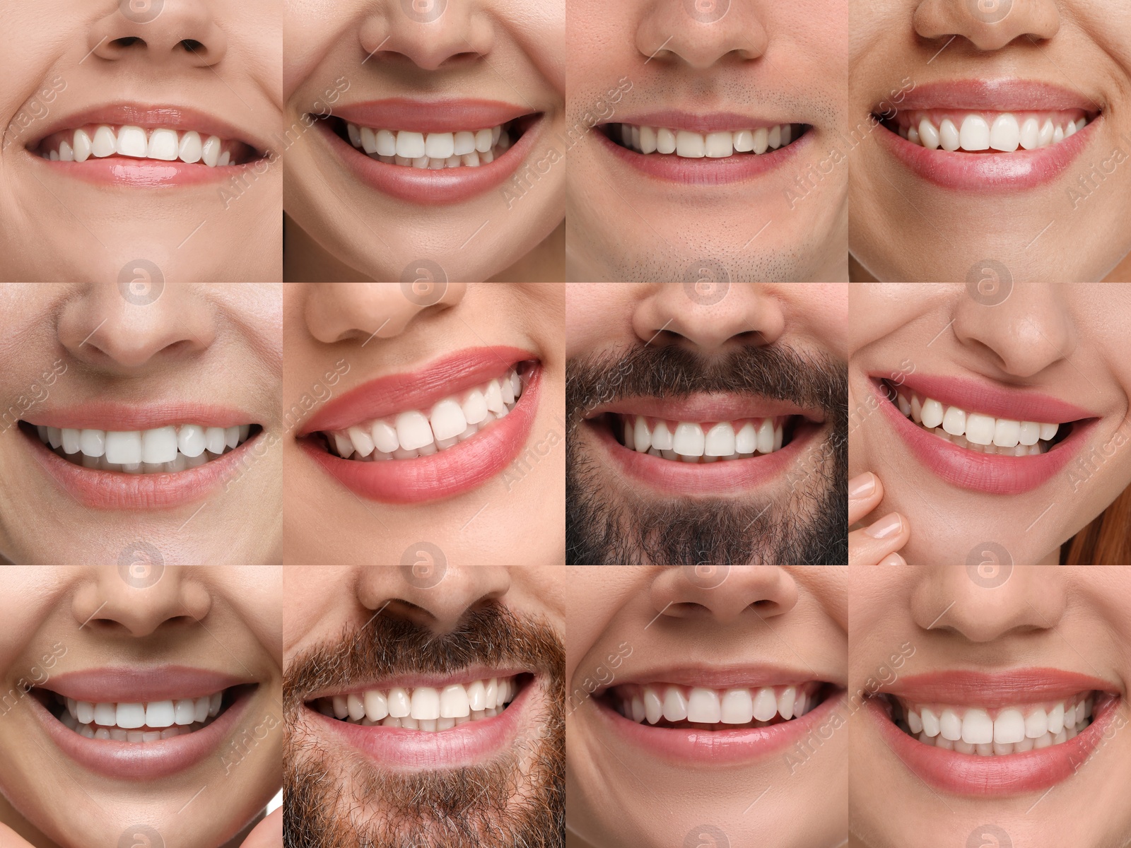 Image of People showing white teeth, closeup. Collage of photos