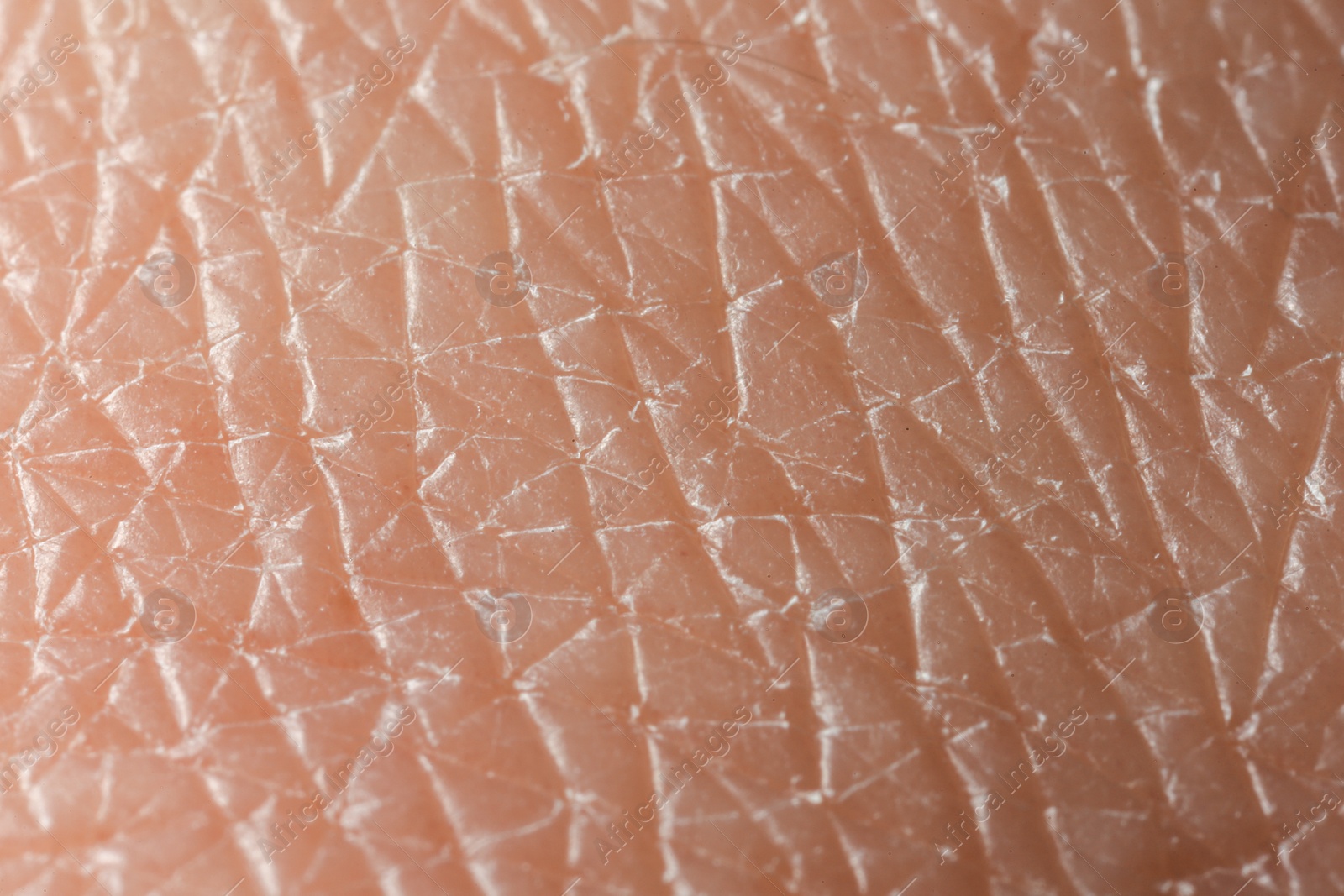 Photo of Texture of dry skin as background, macro view