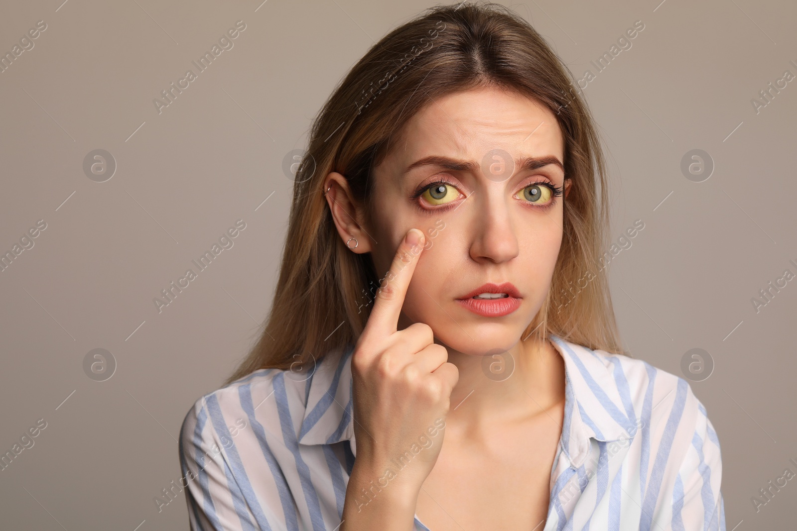 Photo of Woman checking her health condition on grey background. Yellow eyes as symptom of problems with liver