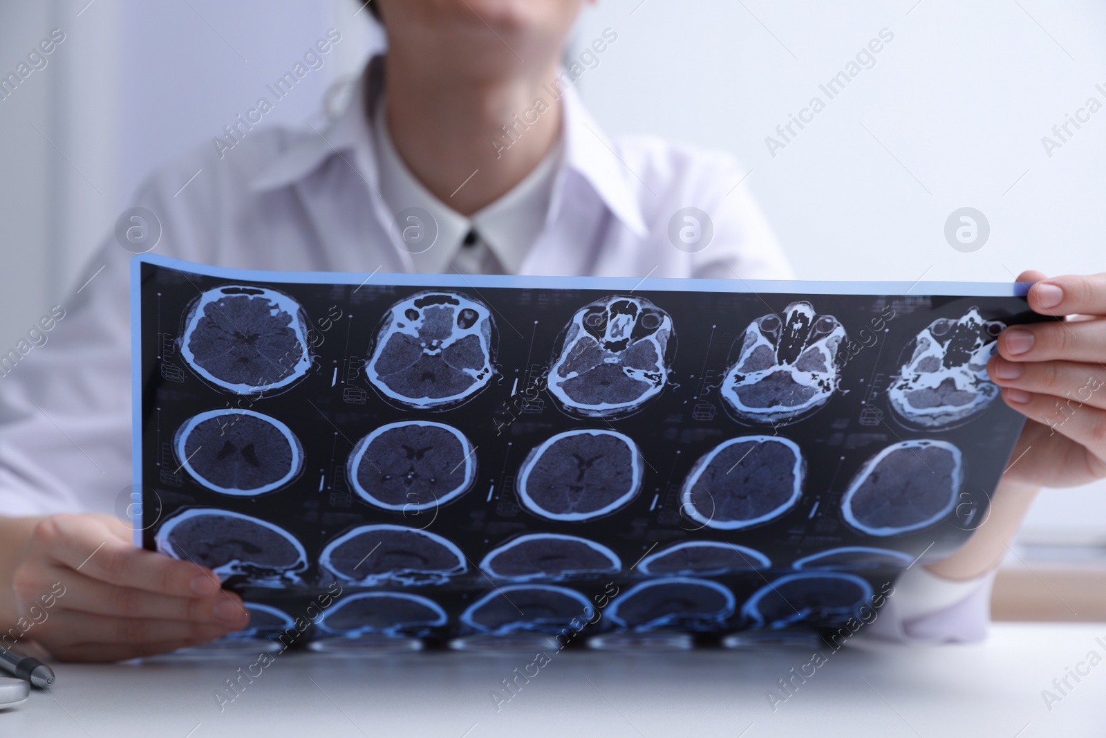 Photo of Doctor examining MRI images of patient with multiple sclerosis at table in clinic, closeup