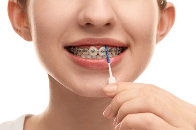 Woman with dental braces cleaning teeth using interdental brush on white background, closeup