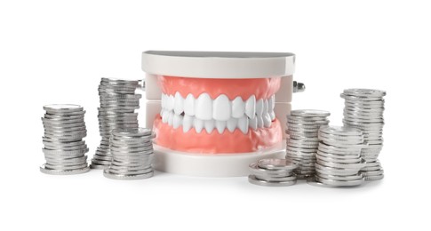 Photo of Educational dental typodont model and coins on white background. Expensive treatment