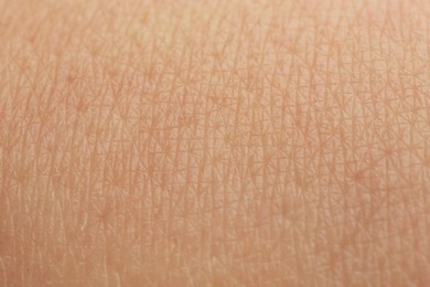 Photo of Texture of dry skin as background, macro view