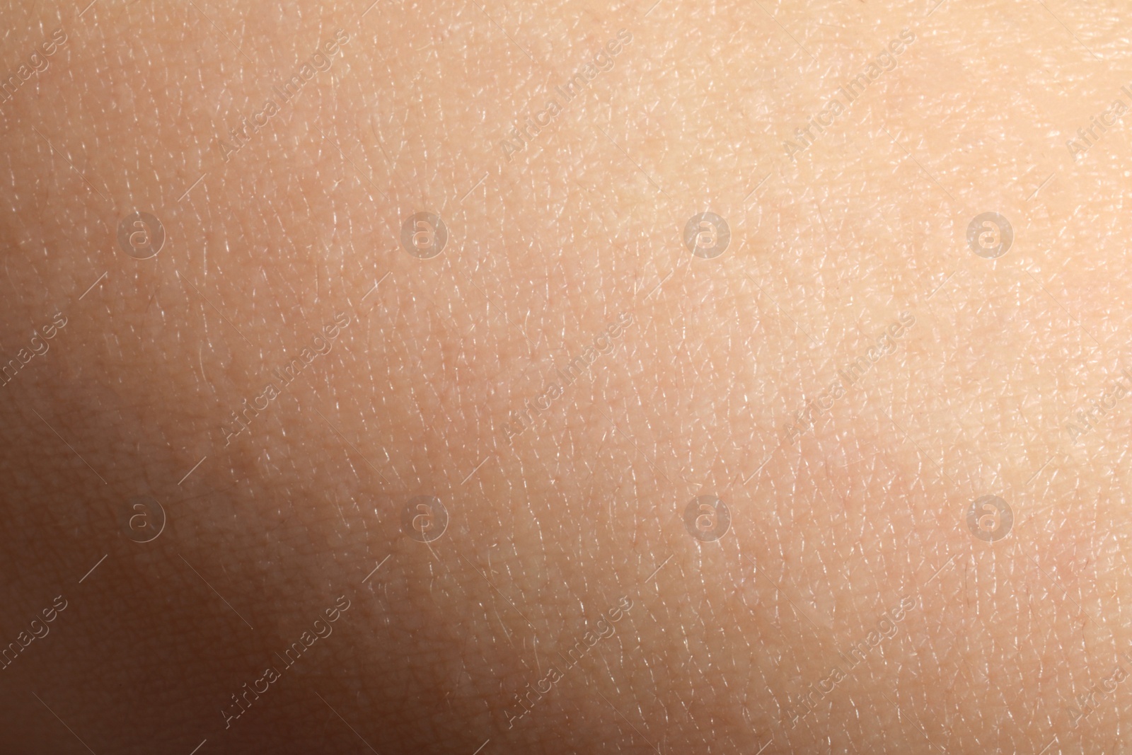 Photo of Closeup view of dry human skin as background