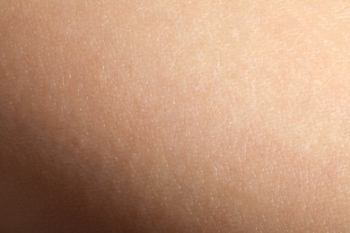 Photo of Closeup view of dry human skin as background