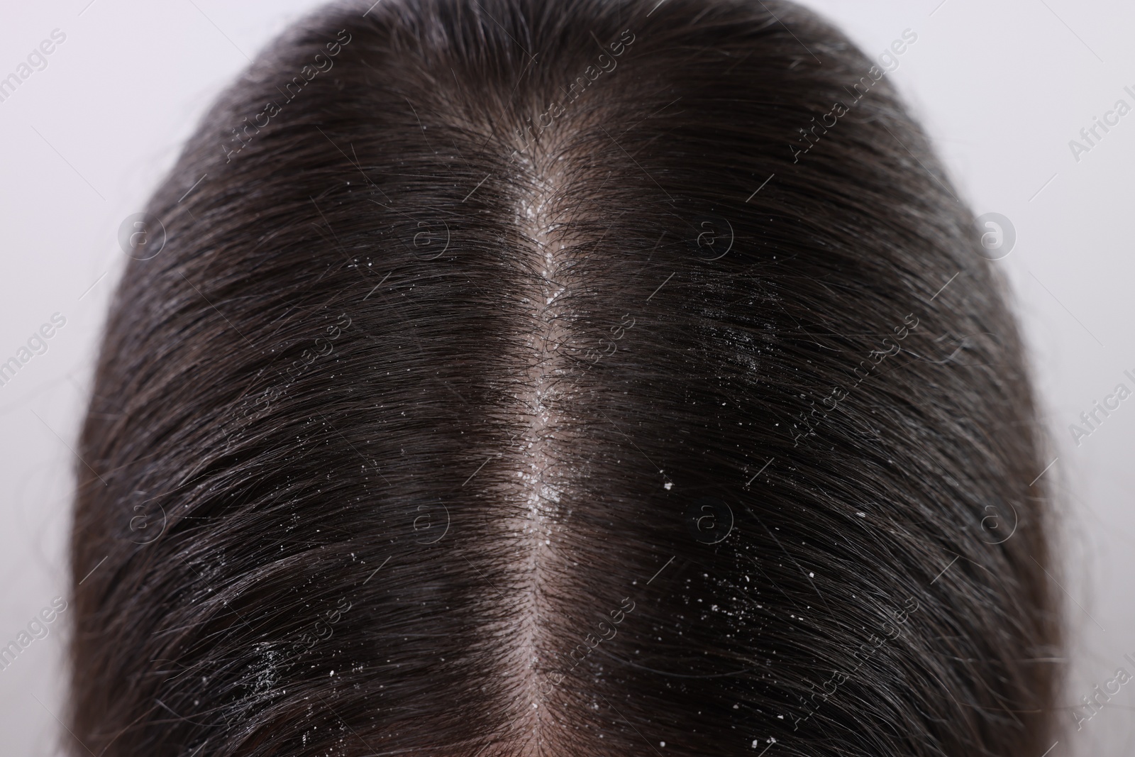 Photo of Closeup view of woman`s dark hair with dandruff on white background
