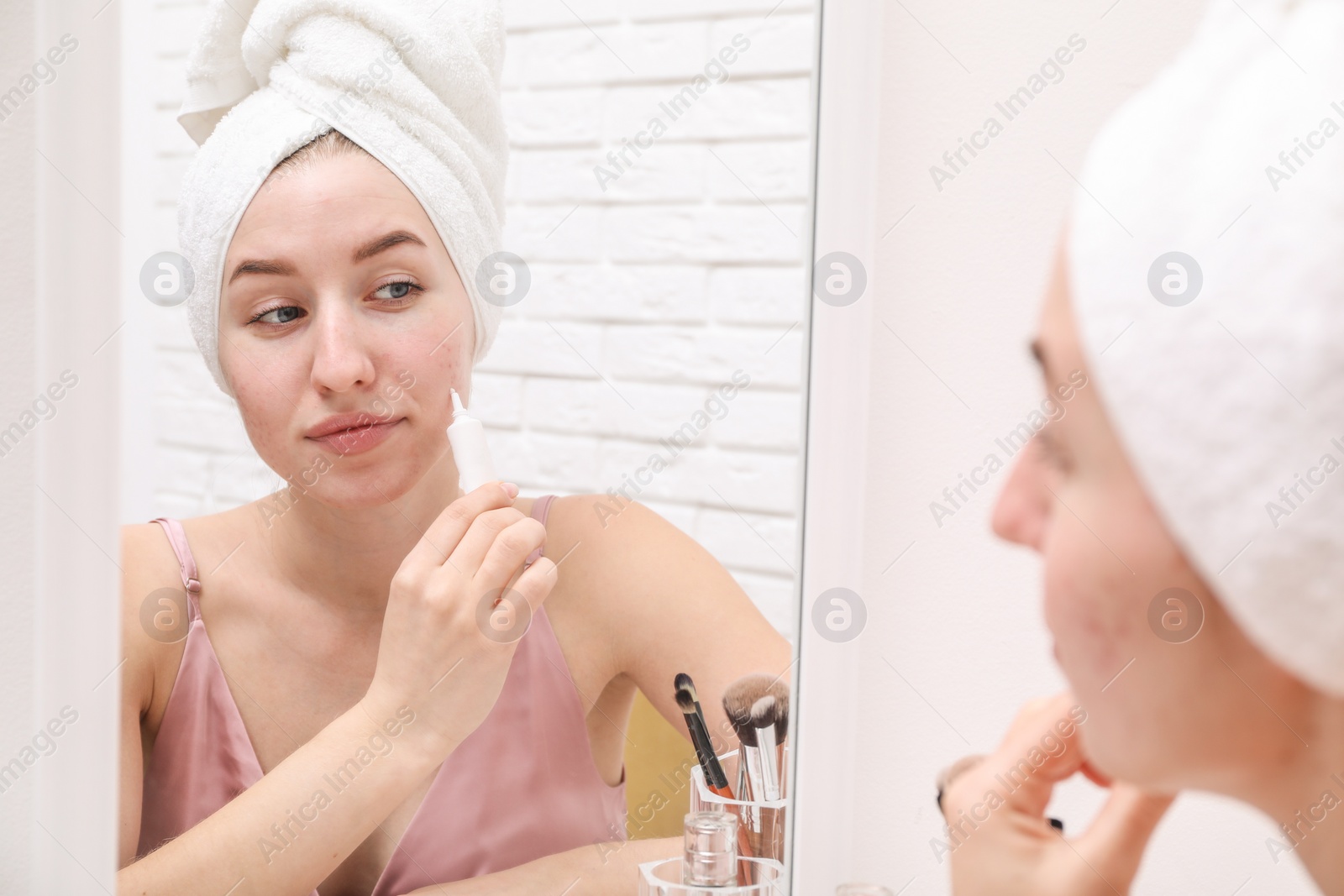 Photo of Woman with acne problem applying cream near mirror indoors