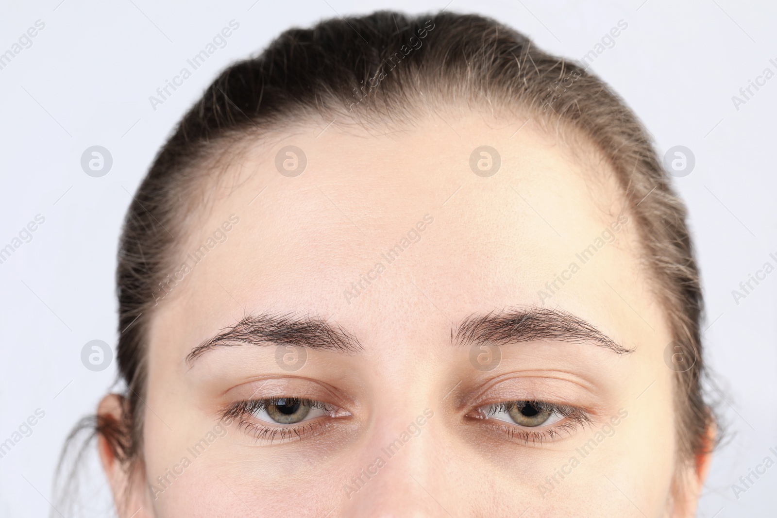 Photo of Woman with dry skin on white background, closeup view