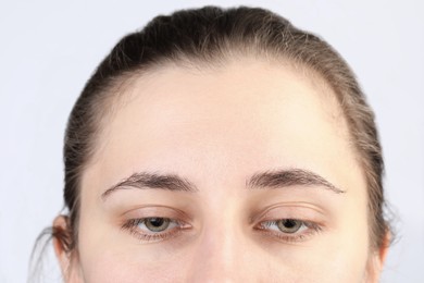 Woman with dry skin on white background, closeup view