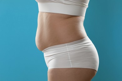 Woman with excessive belly fat on light blue background, closeup. Overweight problem