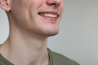 Photo of Young man using whitening strip on light grey background, closeup. Space for text