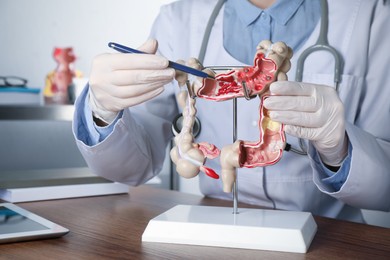 Photo of Gastroenterologist showing human colon model at table in clinic, closeup