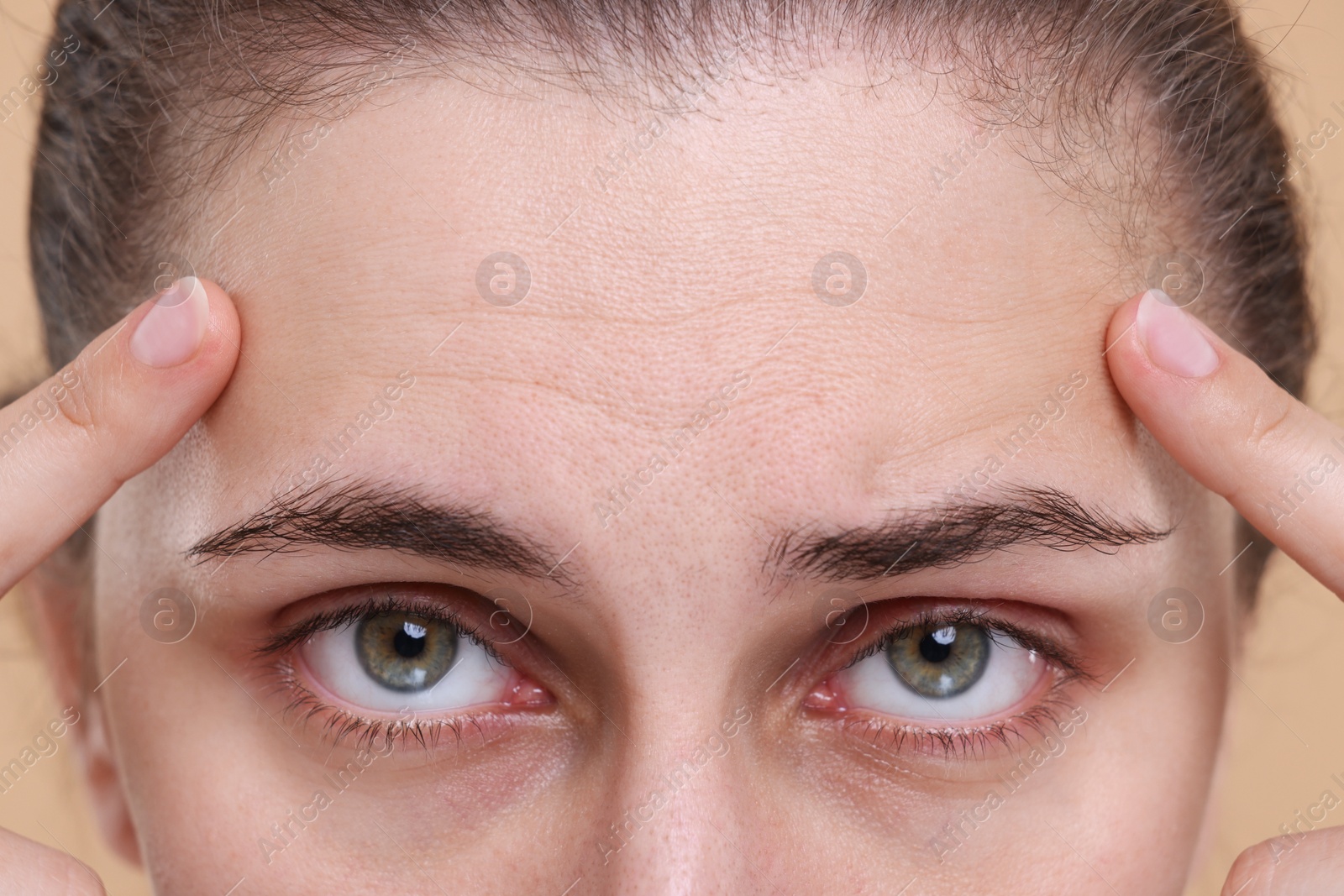 Photo of Closeup view of woman with wrinkles on her forehead