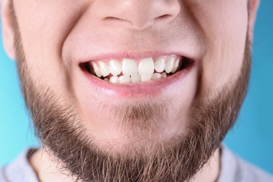 Young man with healthy teeth and beautiful smile on color background, closeup