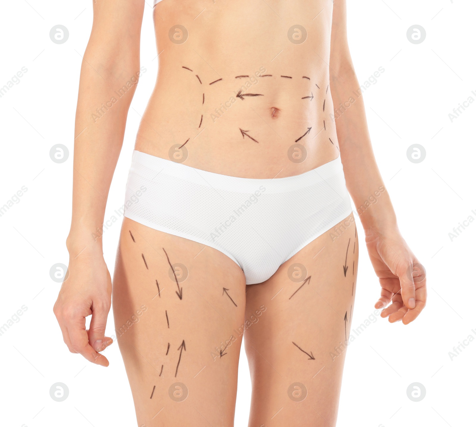 Photo of Woman with marks on body for cosmetic surgery operation against white background, closeup