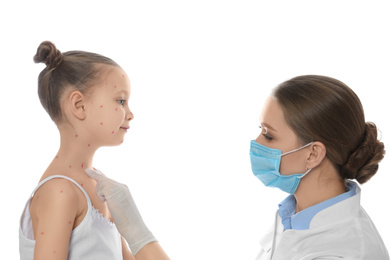 Photo of Doctor examining little girl with chickenpox on white background. Varicella zoster virus