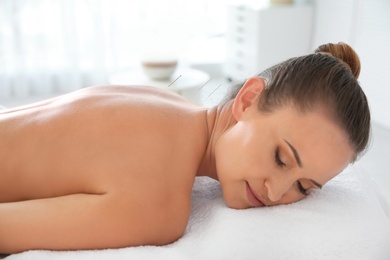 Young woman undergoing acupuncture treatment in salon