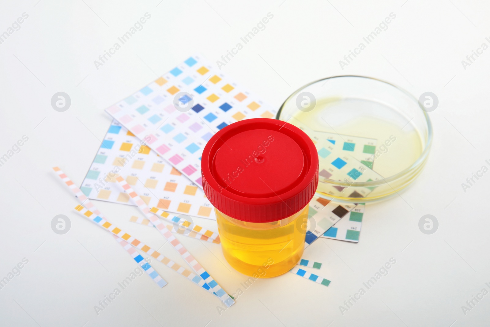 Photo of Laboratory ware with urine samples for analysis on white background