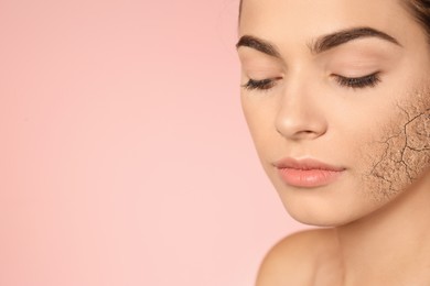 Image of Beautiful young woman with dry skin on pink background, closeup. Space for text