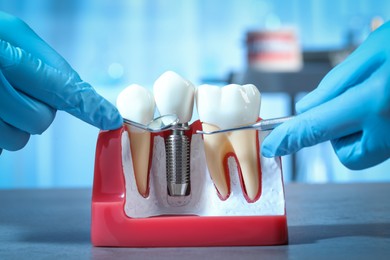 Photo of Dentist with tools pointing at dental implant between teeth in educational model indoors, closeup