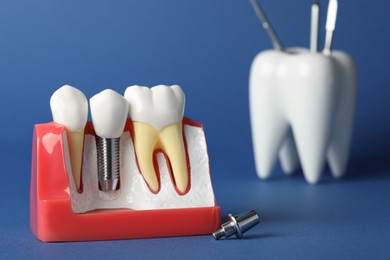 Educational model of gum with dental implant between teeth on blue background. Space for text