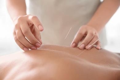 Young man undergoing acupuncture treatment in salon, closeup