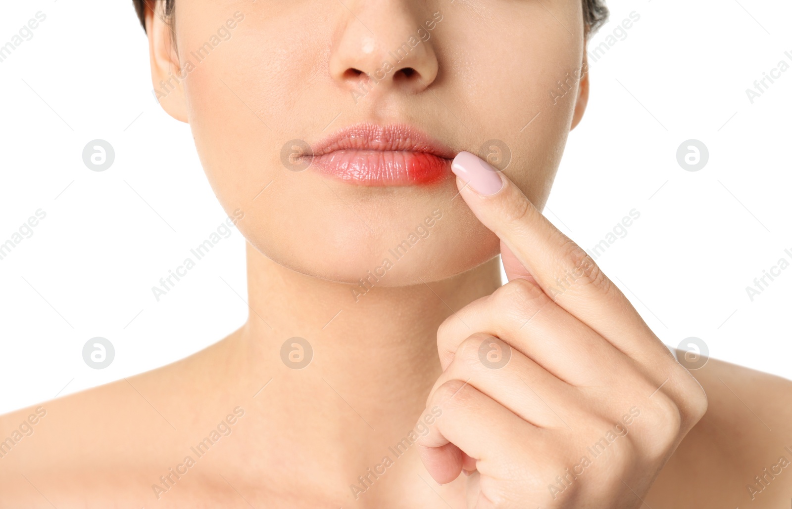 Photo of Woman with cold sore touching lips on white background, closeup