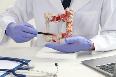 Photo of Doctor showing model of large intestine at white table, closeup